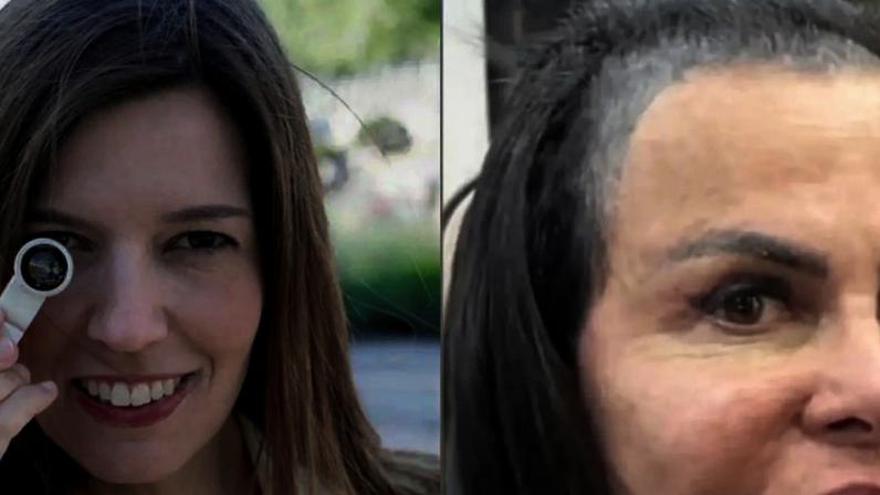 Gretchen sofre com a queda de cabelo.