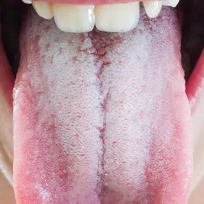 Chiclete e saliva: por que não cola nas mucosas da boca
