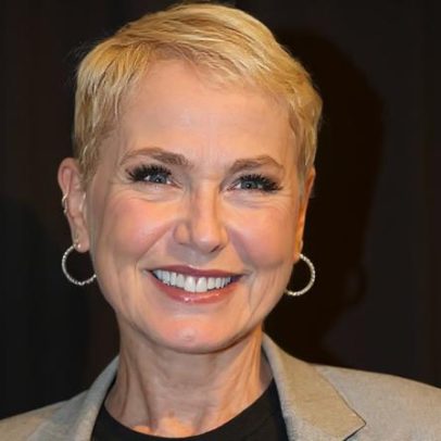Xuxa mostra resultado de transplante capilar e relata impacto da alopecia