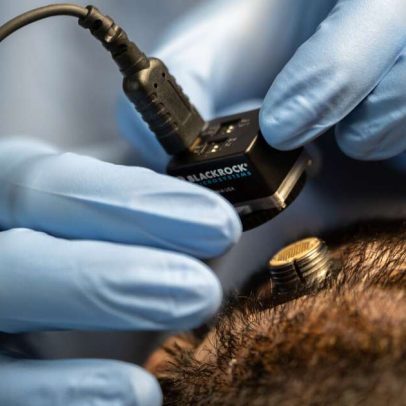 Neurocientistas conectam dois neurônios com fio, criando bypass entre cérebros