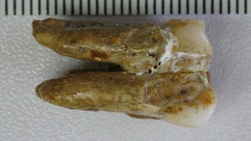 Dente molar de um Homo erectus, com duas raízes e coroa amarelada, exibindo desgaste e manchas escuras, sobre fundo branco com régua milimetrada no topo