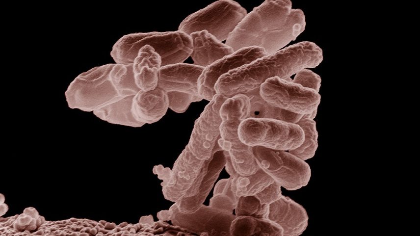 Micrografia eletrônica de varredura colorida de bactérias Escherichia coli, com formato de bastonetes marrons, aglomeradas sobre uma superfície rugosa marrom-avermelhada, em fundo preto