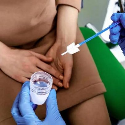 Papanicolau: 10 itens essenciais para o preparo do exame