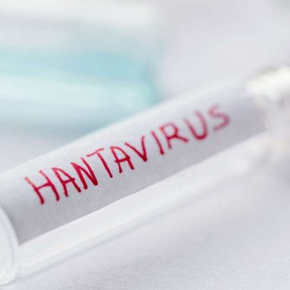 Surto de hantavírus em navio de luxo mobiliza OMS e gera atrito diplomático