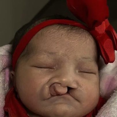 Jady Vitória busca cirurgia que pode transformar sua vida