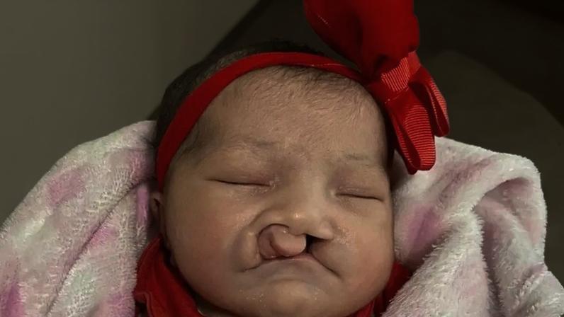 A luta de Jady Vitória pela cirurgia que pode transformar sua vida
