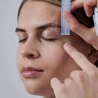 Blefaroplastia requer avaliação pré-cirúrgica personalizada