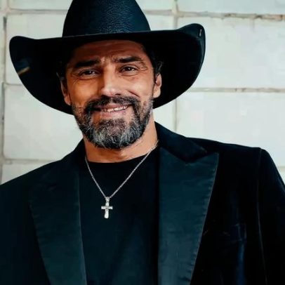 Ex-BBB Alberto Cowboy faz atualização estética nos dentes com lentes de contato