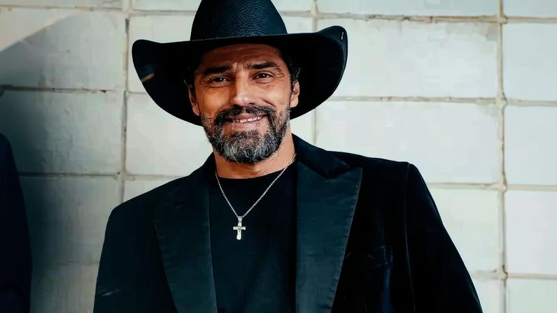 Veja como ficou o sorriso do Cowboy
