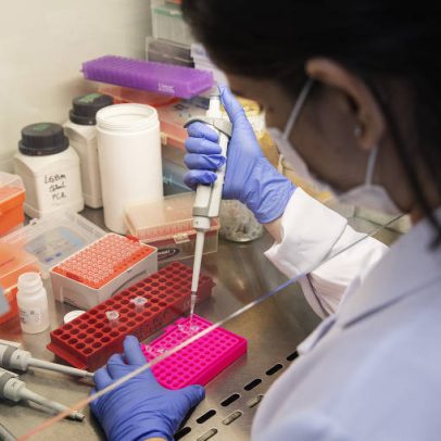 SUS oferecerá teste genético para câncer de mama