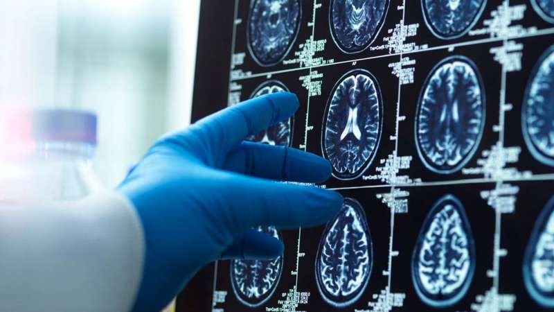 Novo estudo revela que níveis normais de B12 no sangue podem não proteger o cérebro contra lesões e perda cognitiva. Saiba como identificar