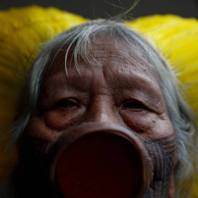 Cacique Raoni recebe alta após diagnóstico de hérnia diafragmática