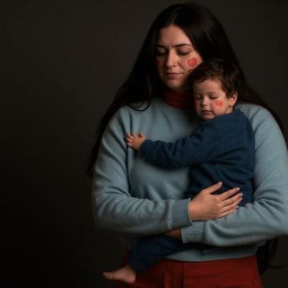 Estudo analisa impacto emocional de perder o colo da mãe