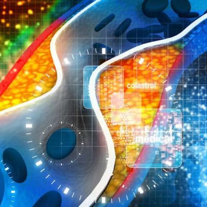 Colesterol LDL e HDL: como atuam no corpo e por que combate o colesterol ruim