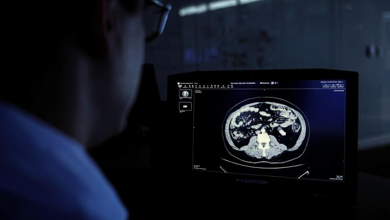 O médico Bruno Aragão, radiologista responsavel pelo HepatIA, que pesquisa uso de um sistema de inteligência artificial para ajudar a identificar lesões e tumores no fígado no Hospital das Clínicas da Faculdade de Medicina da USP - Zanone Fraissat - 14.jun.23/Folhapress