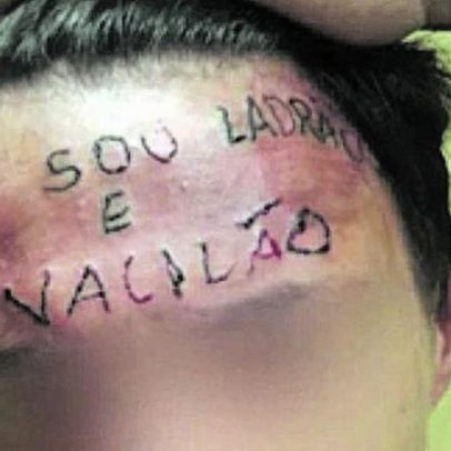 Jovem com testa tatuada à força é condenado por furto em posto de saúde em SP