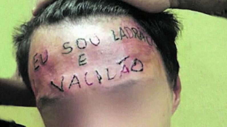 Jovem teve a testa tatuada à força em 2017