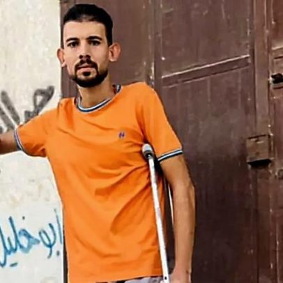 Amputados de Gaza enfrentam escassez de próteses devido ao bloqueio