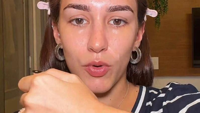 Influenciadora Débora Rocha relembra mordida de cão nos EUA