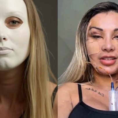 Andressa Urach gasta R$ 100 mil em cirurgias para voltar aos 23 anos