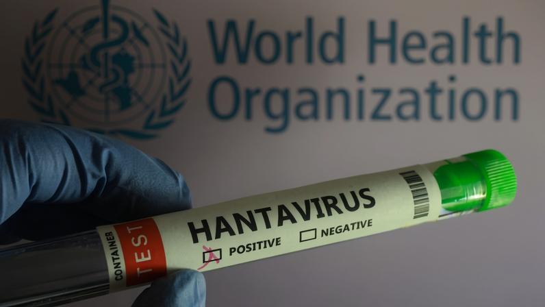 Tubo de ensaio com resultado positivo para hantavírus