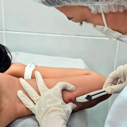 Dor menstrual é subnotificada no SUS, aponta estudo com 21 vezes mais casos