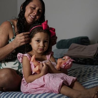 Doença mão-pé-boca é infecção altamente contagiosa em crianças