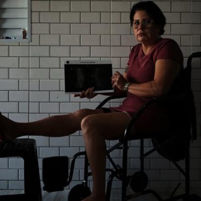 Mulher aguarda cirurgia desde 2022 em SP; ligações para confirmar que está viva