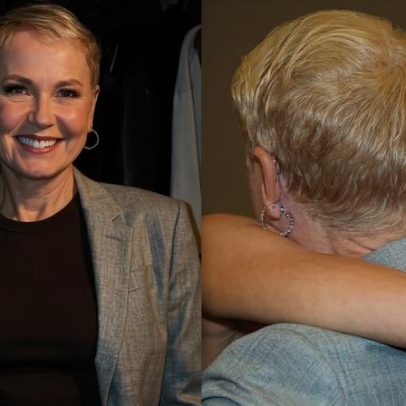 Xuxa celebra resultado ótimo de transplante capilar