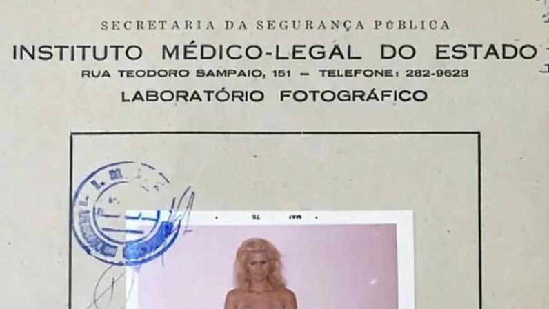 Fotografia de Waldirene em laudo do IML, feita em 1976; ela teve negado o pedido do habeas corpus preventivo para não ser submetida ao exame (a marca protegendo os seios foi feita pela BBC Brasil)