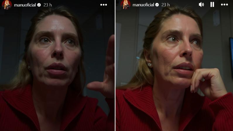 Segundo Manu Bahtidão, o procedimento durou cerca de 20 minutos: 'É indolor'