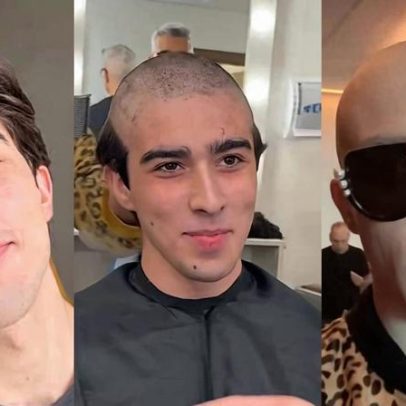 Ator que viverá Paulo Gustavo no teatro fica careca; veja o antes e depois
