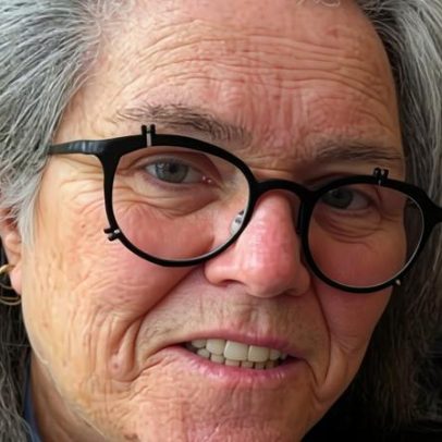 Rosie O'Donnell admite crise após facelift caro e crítica o feminismo