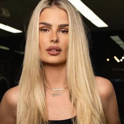 Yasmin Brunet afirma que homem bêbado percebeu lipedema antes de médicos