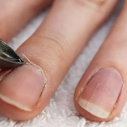 Tirar a cutícula toda semana pode danificar unhas: entenda os riscos