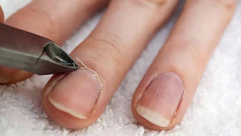 Retirar as cutículas com frequência pode deixar as unhas mais vulneráveis a infecções e danos