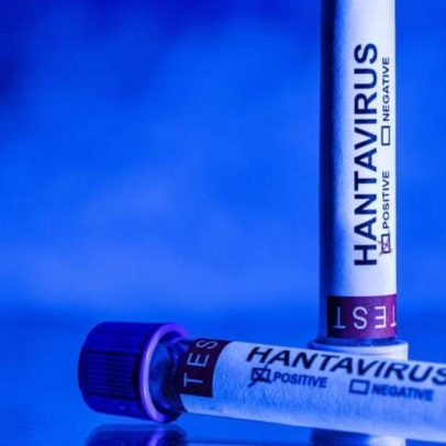 Mais de 20 franceses expostos ao hantavírus permanecem hospitalizados