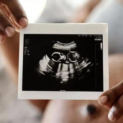 Sentidos do bebê começam a se formar na gestação