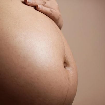 Cistoscopia fetal trata obstrução urinária grave