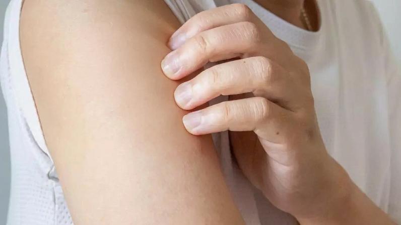 Coceira no corpo persiste? Principais causas e o que fazer