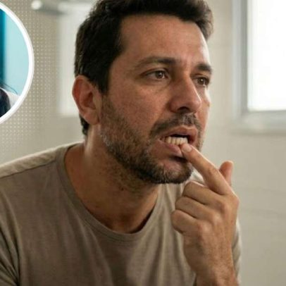Dente mole em adultos pode indicar problema de saúde, quando buscar atendimento