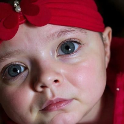 Pequena Melissa enfrenta luta pela saúde