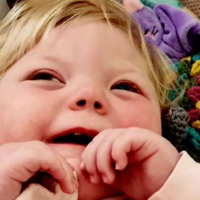 Bebê de 2 anos é a única portadora mundial de condição ultrarrara