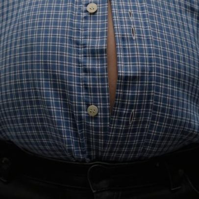 Doenças cardíacas representam 41% das mortes entre pessoas com obesidade