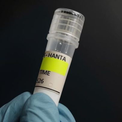 RS confirma dois casos de hantavírus; um homem morreu