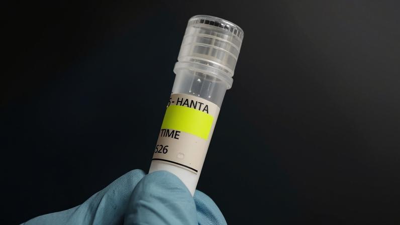 A hantavirose é uma doença transmitida por meio de urina, saliva, fezes ou pela própria mordida de roedores silvestres contaminados - (crédito: AFP )
