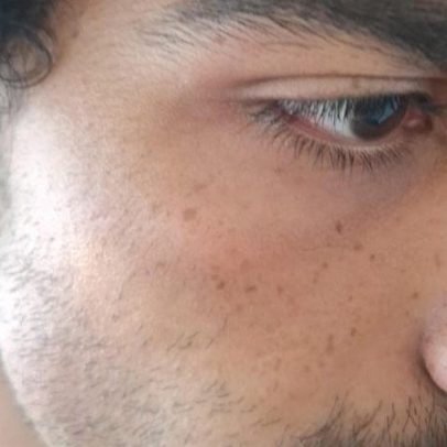 Estudante da UnB é agredido dentro de supermercado