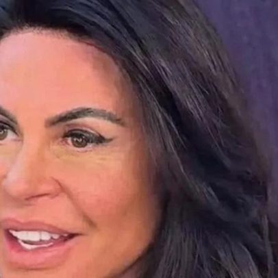 Gretchen revela rotina para esconder alopecia do marido