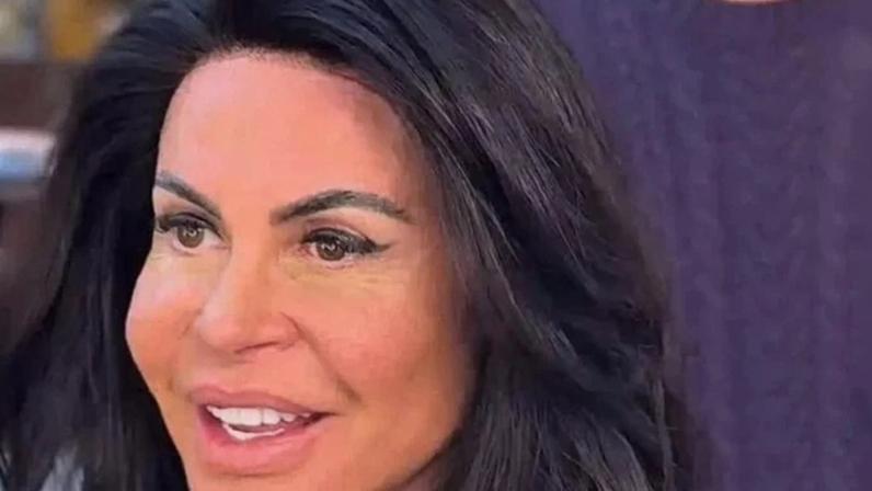 Gretchen choca ao revelar rotina para esconder alopecia do marido - (crédito: Observatorio dos Famosos)