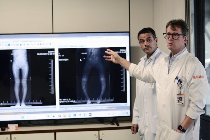 Dr. Cláudio Alberto (D) e Dr. Rafael Valadares participam do projeto de ortopedia preventiva no Hospital Sarah Kubitschek de Brasília